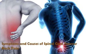 Symptoms and Causes of Spinal Cord Tumour Back Pain
