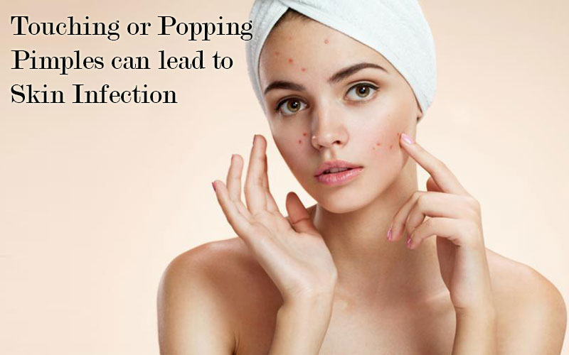 Touching or Popping Pimples can lead to Skin Infection