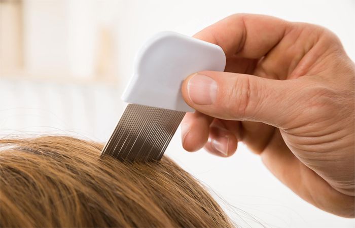 Suffering From Itchy Scalp Hair Shedding?
