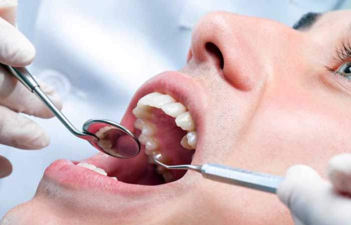 6 Tips to Prevent and Treat Gum Diseases
