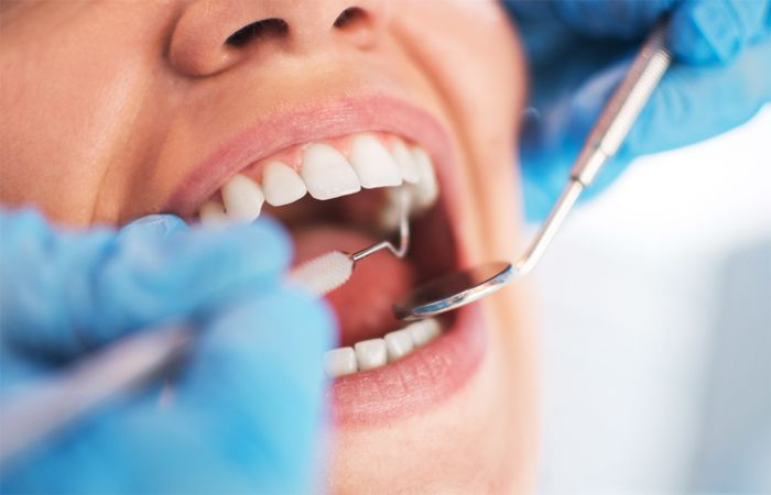 Surprising Benefits of Good Oral Hygiene