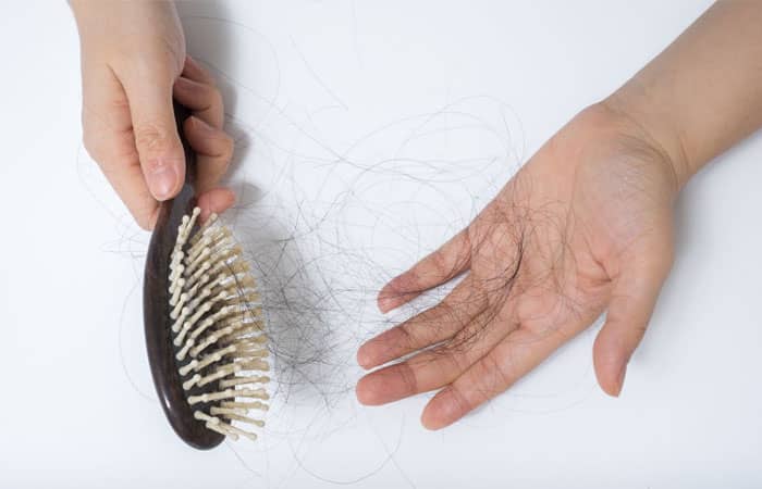Causes, Treatments Tips for hair loss