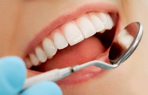 Periodontal Disease-and Missing Teeth Affect Health