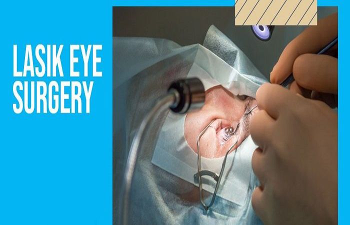Everything You Need to Know About LASIK Eye Surgery