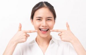 Braces Aftercare Tips