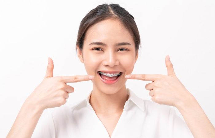 Braces Aftercare Tips Recommended By Orthodontists