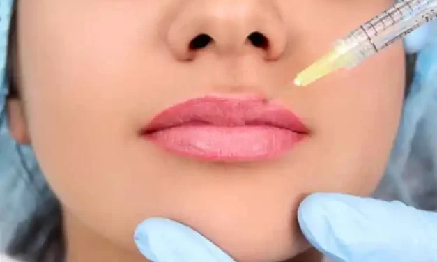 Lip Fillers: 6 Tips for Choosing a Good Clinic in Manchester