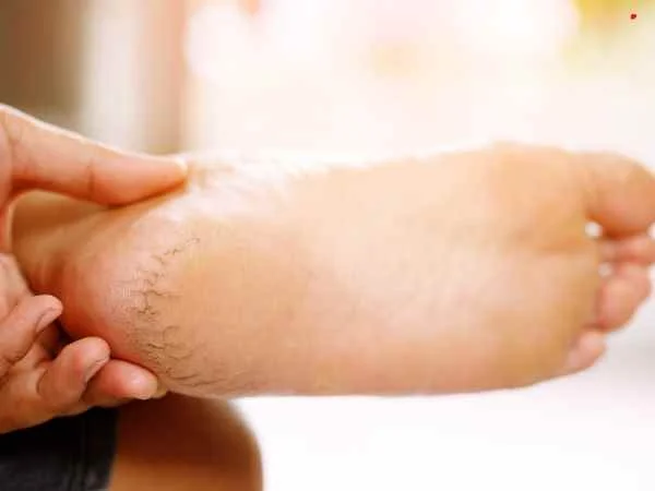 5 Reasons Your Ankles Crack and Should You Be Worried?